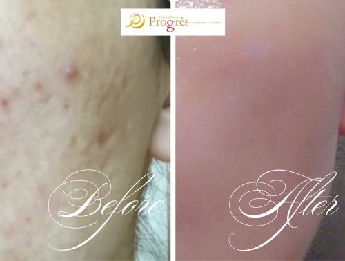 額あり掲載用作成画像23枚 (7).png