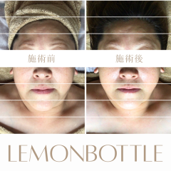 LEMON - 1.png