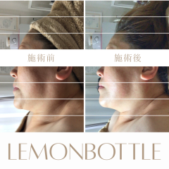 LEMON - 2.png