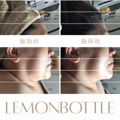 LEMON - 3.png