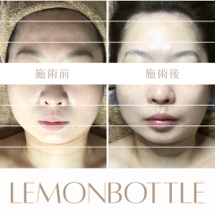 LEMON - 4.png