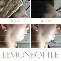 LEMON - 5.png