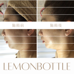 LEMON - 6.png