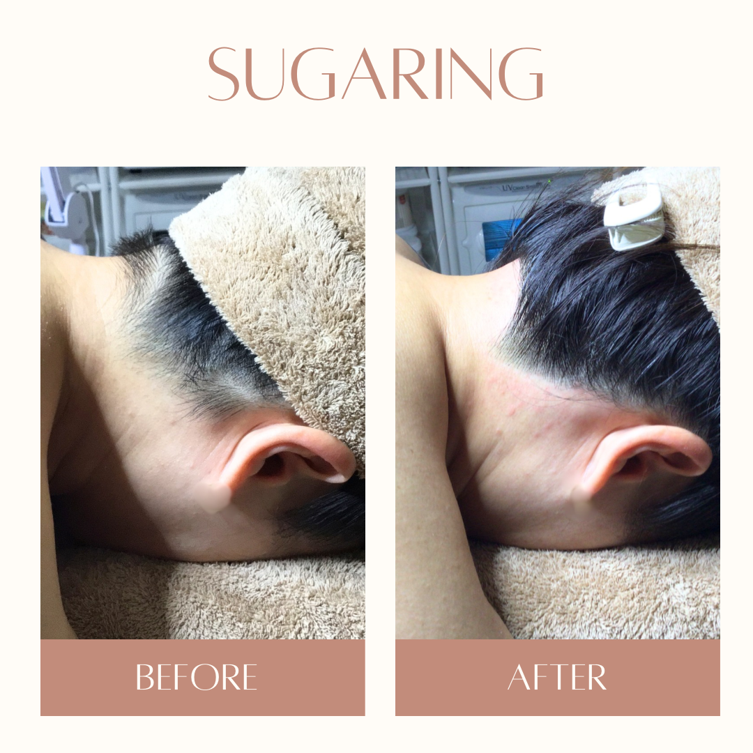 うなじシュガーリング