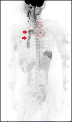 mri_006.jpg