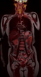 mri_010.jpg