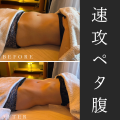 腸 も み で 下 腹 へ こ む.png