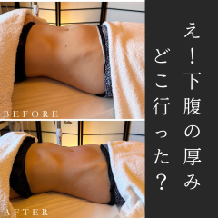 腸 も み で 下 腹 へ こ む.png