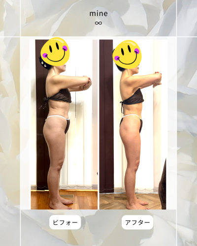 ビフォーアフター①.png