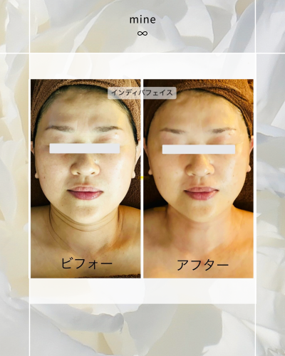 ビフォーアフター⑩.png