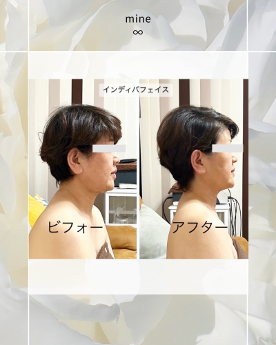 ビフォーアフター⑪.png
