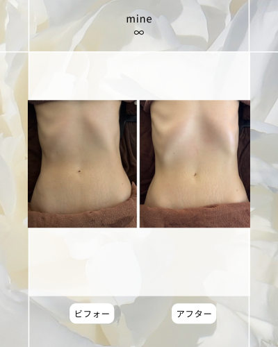 ビフォーアフター③.png