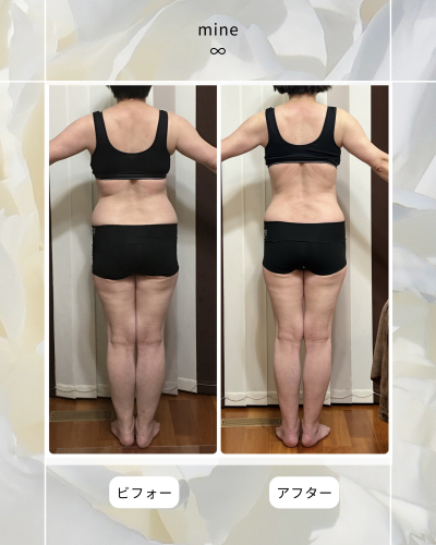 ビフォーアフター④.png