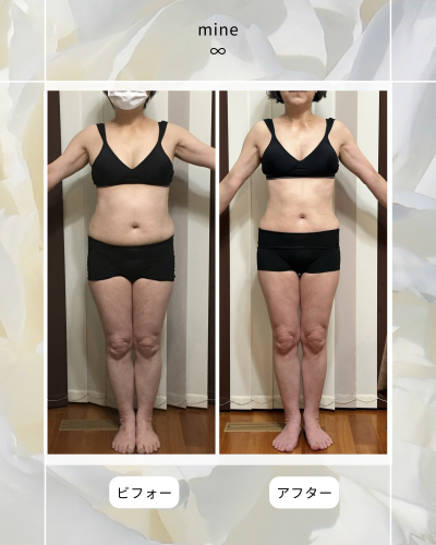 ビフォーアフター⑤.png