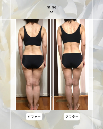 ビフォーアフター⑦.png