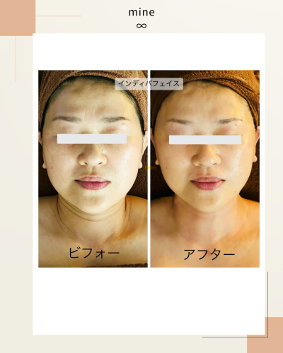 ビフォーアフター⑩.png