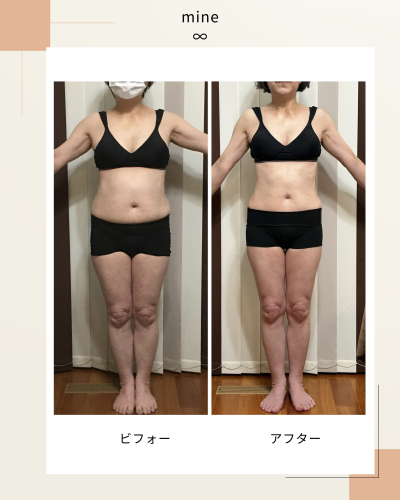 ビフォーアフター⑤.png