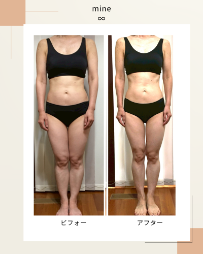 ビフォーアフター⑥.png