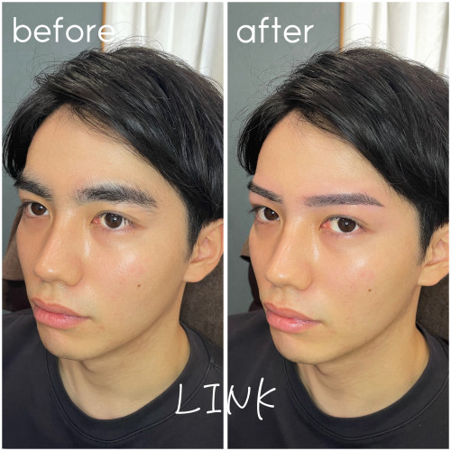 wax脱毛ってなに？効果はある？