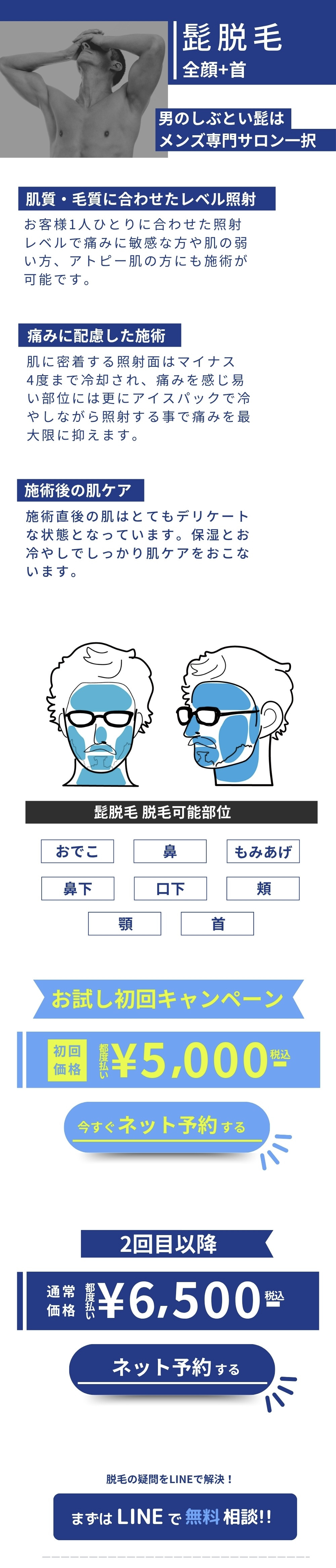 宝塚 髭脱毛