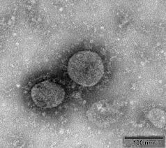  Coronavirus