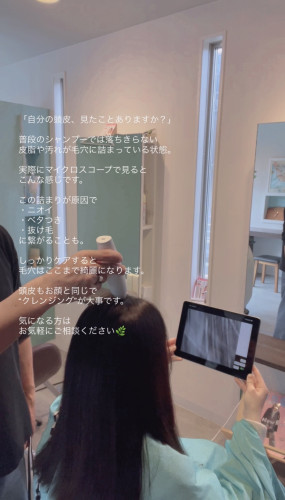 マイクロスコープ頭皮診断スタートしました