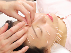 【トライアルお一人様／１回】プラチナ美容鍼