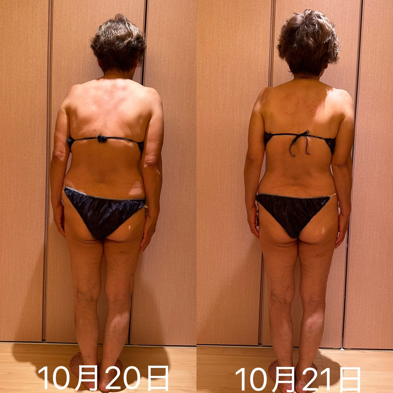 2日続けてトリートメントしました。