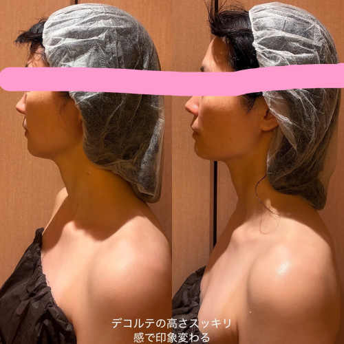 フェイシャルとバストケアをしました。