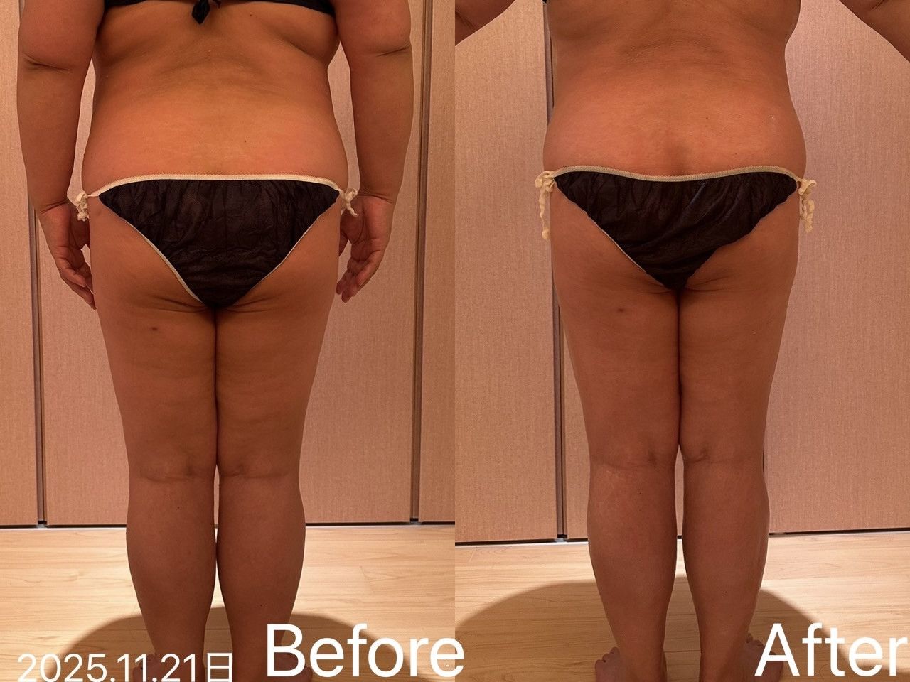 GRACE HARB でボディをトリートメントしました。