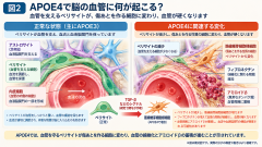 APOE4が脳血管に及ぼす変化.png