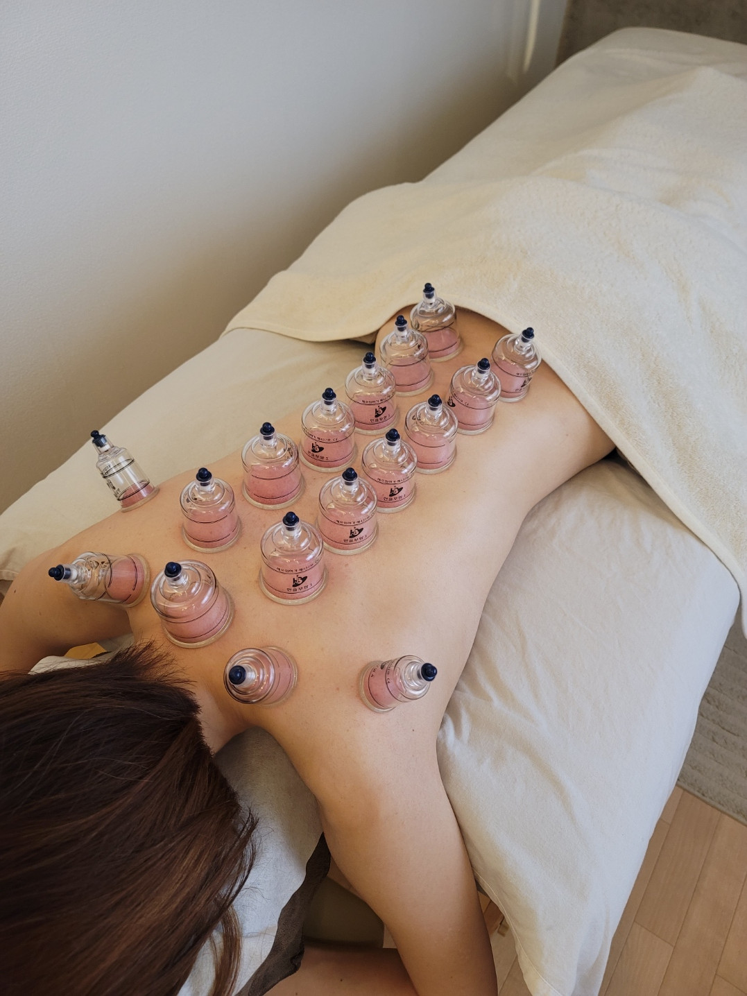 カッピング