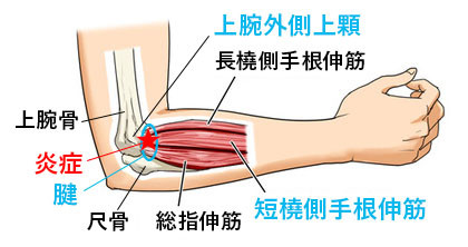 家事中に多い？肘の痛みでお困りならうるまの匠整骨院へ