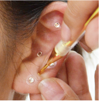 耳ツボ　セラピー