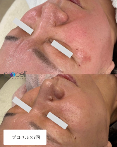 プロセル×7回.png