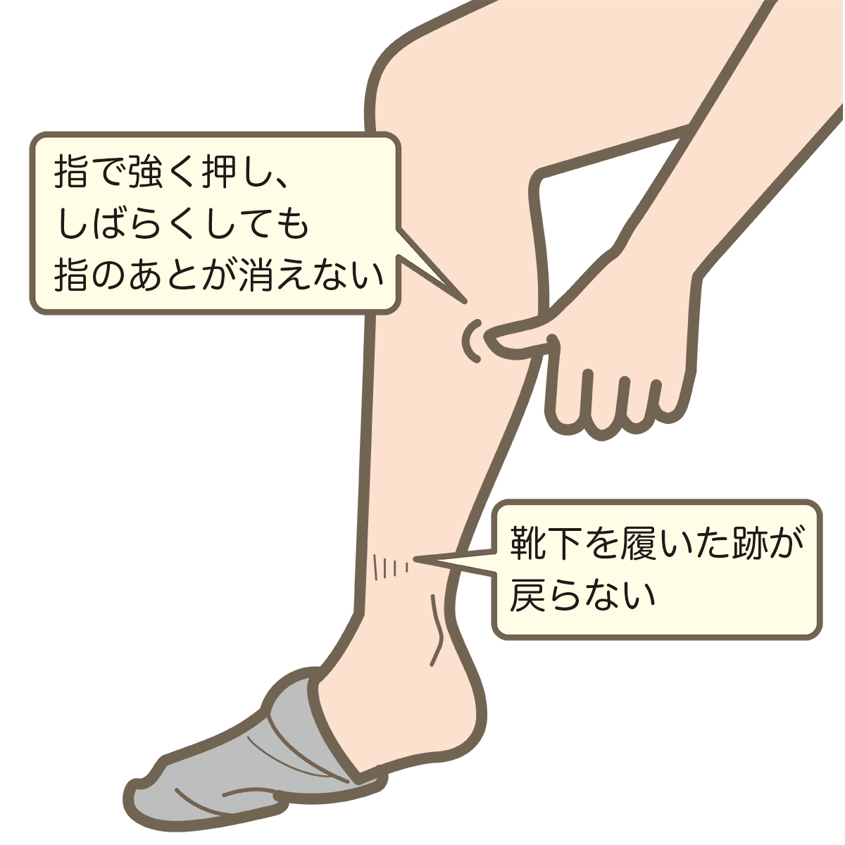 足のむくみ・浮腫について