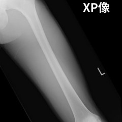 XP像.jpg