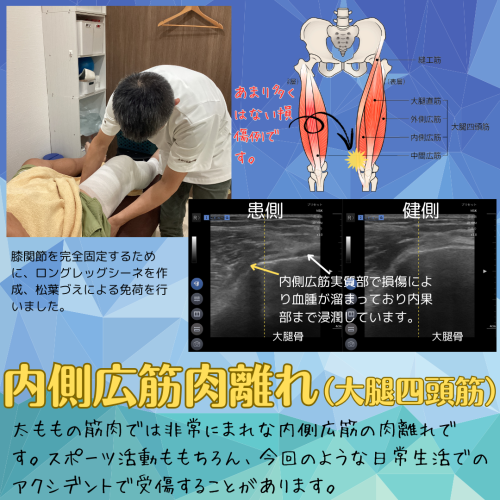 インスタ投稿（症例） (3).png