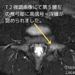 インスタ投稿（症例） (13).png