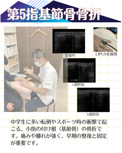 インスタ投稿（症例） (297 x 200 mm) (Instagramの投稿（45）) (1).png