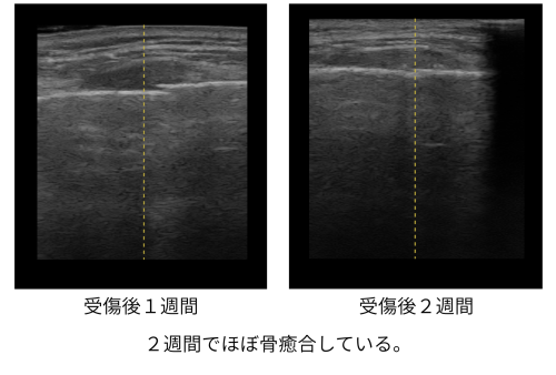 HP症例報告用.png