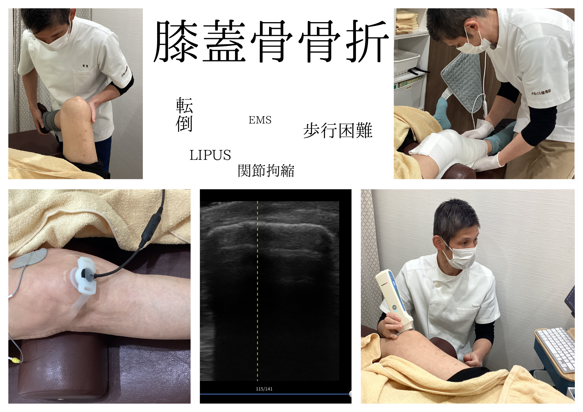 今月の症例報告は膝蓋骨骨折です。