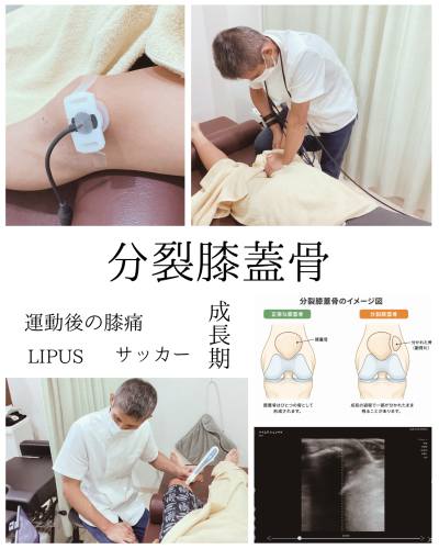 症例報告のインスタ投稿用 (Instagramの投稿（45）) (3).png