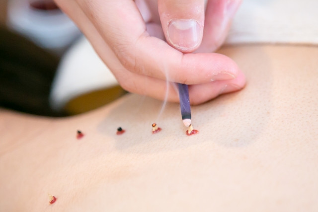 冷えにはお灸がおすすめ