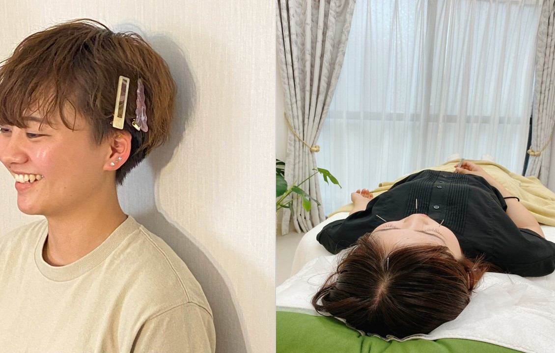 調子の良い日が増えていくからだへ　基本のはり