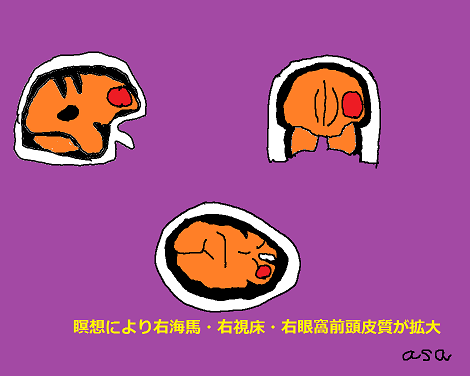 20160312_1594681.png