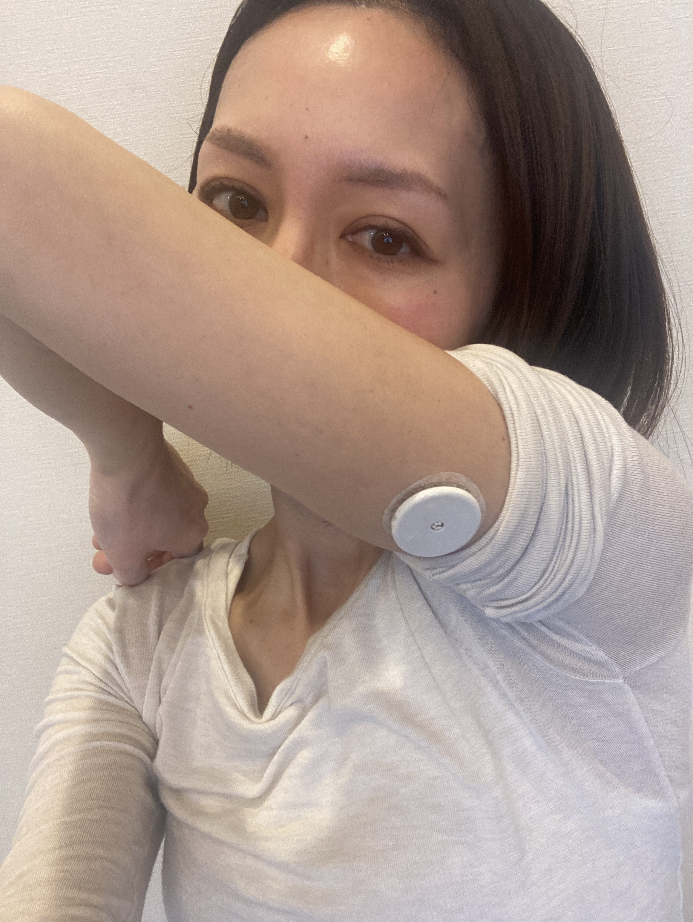 持続血糖測定器