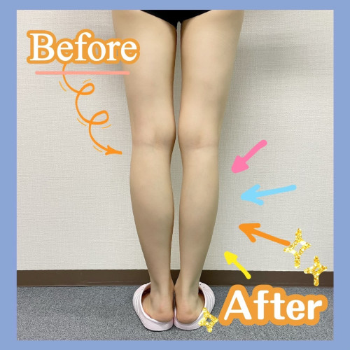 痩身（そうしん）MENU追加しま【女性限定】
