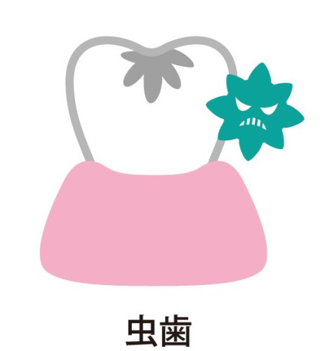 削らない治療