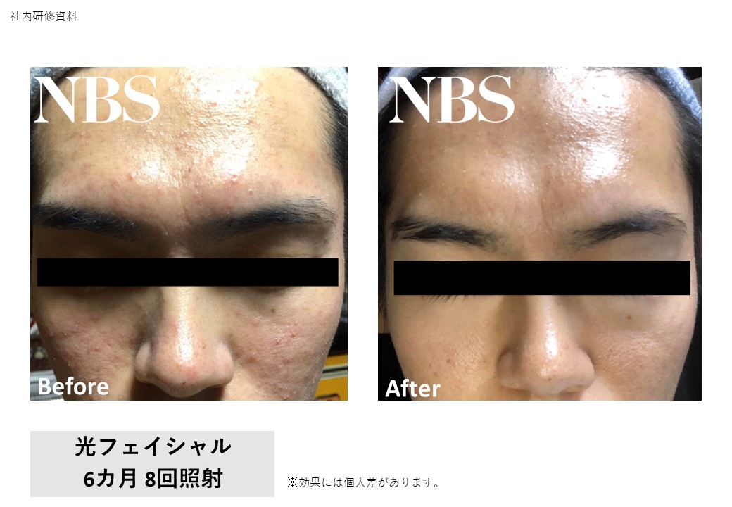 光フェイシャル男性.png
